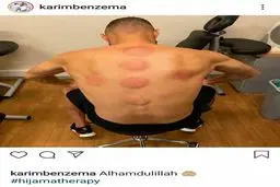 ستاره رئال به طب اسلامی روی آورد + عکس