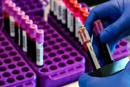 پزشکان چک: نزدیک به ۸۰ درصد از کیت‌های چینی تست کرونا درست کار نمی‌کنند
