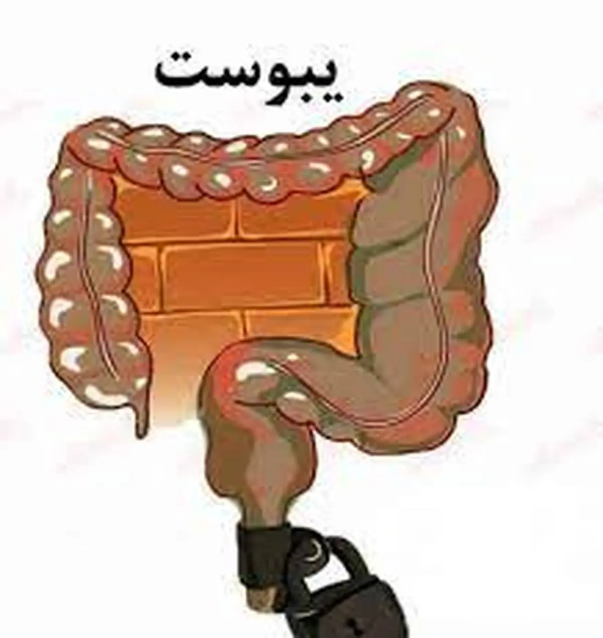 علت یبوست چیست؟ | درمان یبوست با روش خانگی +ویدئو