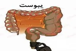 این ورزش ده برابر موتور روده رو قوی تر می‌کنه! | می‌دونستی حتما روزی یکبار باید دفع غذا داشته باشی؟ | ورزش آسان برای رفع یبوست +ویدئو