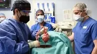  علت مرگ بیمار دریافت‌کننده قلب خوک اصلاح ژنتیکی شده اعلام شد
