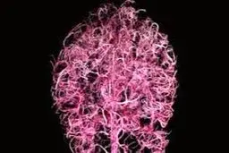  داروی جدید آلزایمر + اسم و مشخصات