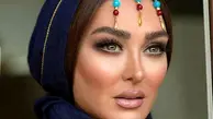 الهام حمیدی چهره اش را دستخوش تغییراتی کرده +عکس