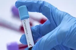 
دانشگاه علوم پزشکی گلستان: تاکنون آزمایش کرونای ۳۹۱ نفر مثبت اعلام شده