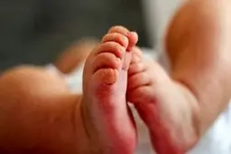 
تغییر شکل پای کودک سلامت او را تهدید می‌کند

