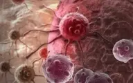 دومین سرطان شایع در میان مردان را بشناسید