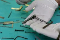  خارج کردن ۱۵۸ شیء فلزی از معده یک زن!+ویدئو 