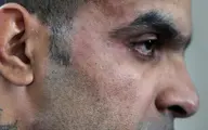 روایت یکی از قربانیان پرونده متجاوز سریالی در تهران | در اتوبان‌های اطراف پارک چیتگر به من تجاوز کرد