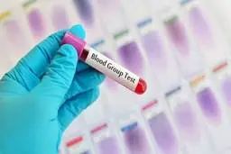 کشف یک گروه خونی نادر | گروه خونی کمیاب و جدید