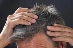 استرس یکی از عوامل سفیدی موی انسان است 