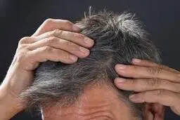 استرس یکی از عوامل سفیدی موی انسان است 