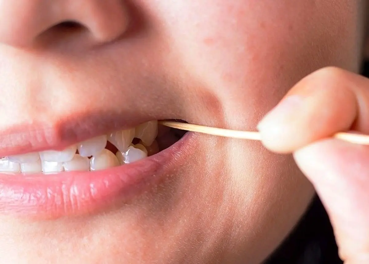 هرگز از خلال دندان استفاده نکنید | مضرات خطرناک خلال دندان