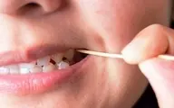 هرگز از خلال دندان استفاده نکنید | مضرات خطرناک خلال دندان