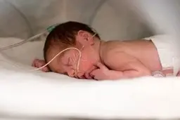 پیش‌بینی زایمان زودرس با نشانگرهای زیستی اپی ژنتیک