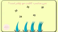 قبل از اینکه برای کاشت مو تصمیم بگیرید این نکات را بخوانید