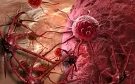 HPV و یک سرطان زنانه