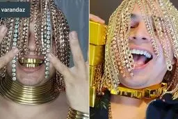 اولین فرد در جهان که به جای مو، روی سرش زنجیر طلا کاشته است!