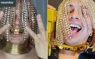 اولین فرد در جهان که به جای مو، روی سرش زنجیر طلا کاشته است!