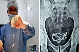  شارژر موبایل چطور از مثانه ی این مرد سردرآورده؟