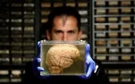 محققان می‌گویند مغز پولدارها دیر پیر می‌شود