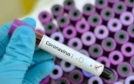 تعداد مبتلایان ویروس کرونا در منطقه کاشان به ۹ نفر رسید