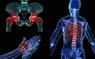 بیماری پوکی استخوان: علایم و شیوع تا درمان