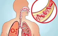 مهمترین نشانه های کمبود اکسیژن در بیماران کرونایی