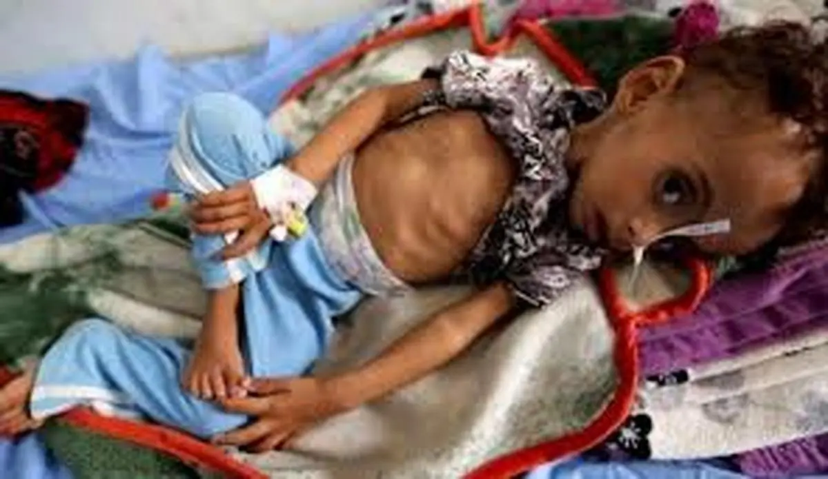 هشدار سازمان ملل  |  «شمارش معکوس تا فاجعه در یمن» 