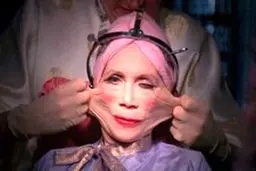 عجیب‌ترین جراحی‌های زیبایی در دنیا  +عکس