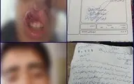 مجروح شدن دانش آموز زنجانی بر اثر ضرب و شتم معلم ورزش!