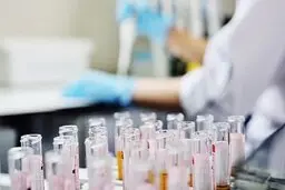 WHO ابتلای مجدد برخی از بهبودیافتگان کووید-۱۹ را بررسی می‌کند