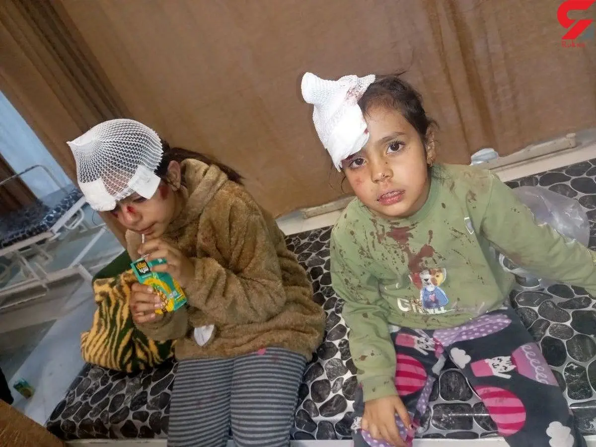 حمله وحشتناک سگ ها ی ولگرد به 2 دختر بچه در کرمانی+ عکسهای وحشتناک