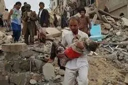 روزانه ۱۵ تا ۲۵ بیمار به علت نبود امکان سفر به خارج یمن می‌میرند