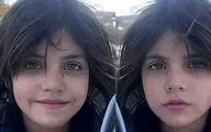 زیباترین کودک جهان، یک کودک کار ایرانی‌ست! | چشمان  خیره‌کننده این کودک کار