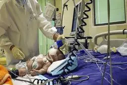 افزایش ابتلای کودکان به کرونا در کشور