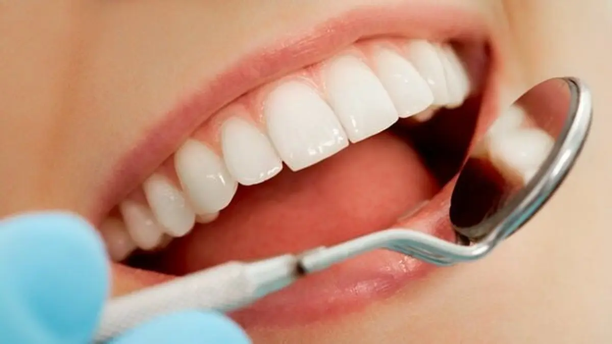 آیا محصولات سفیدکننده به دندان‌ها آسیب می‌زنند؟