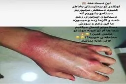 دست های یک پرستار