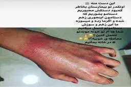 دست های یک پرستار