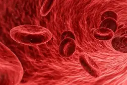  علائم شایع هموفیلی +اینفوگرافیک