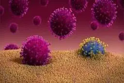 "سکته مغزی" شایعترین علائم عصبی در بیماران کرونایی است.