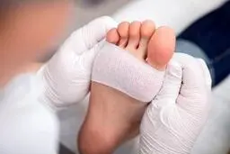 فناوری مدرن برای درمان زخم و پای دیابتی 