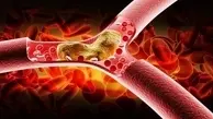  درمان طبیعی برای کنترل  کلسترول خون
