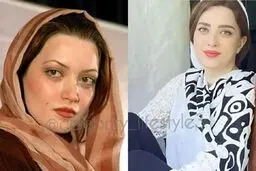 بهنوش طباطبایی با 100 میلیون دگرگون شد | چهار عمل زیبایی که بهنوش طباطبایی را جوان کرد + عکس