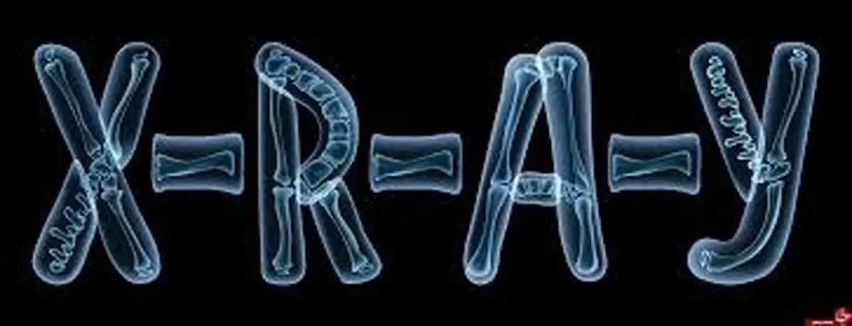 اشعه ایکس چگونه کشف شد؟ | کشف تصادفی که جهان را تغییر داد +ویدئو