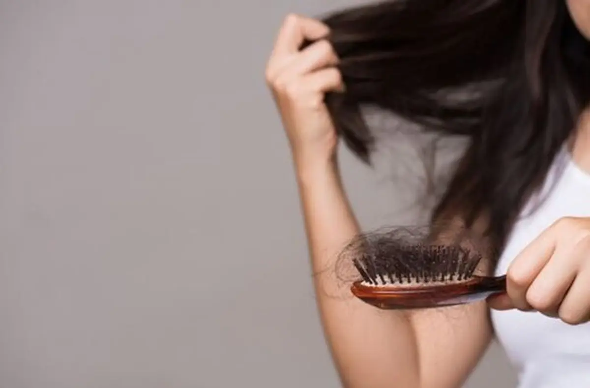 علائم ریزش غیر طبیعی مو | اگه موهات اینجوری شده سریعا به متخصص مو مراجعه کن!