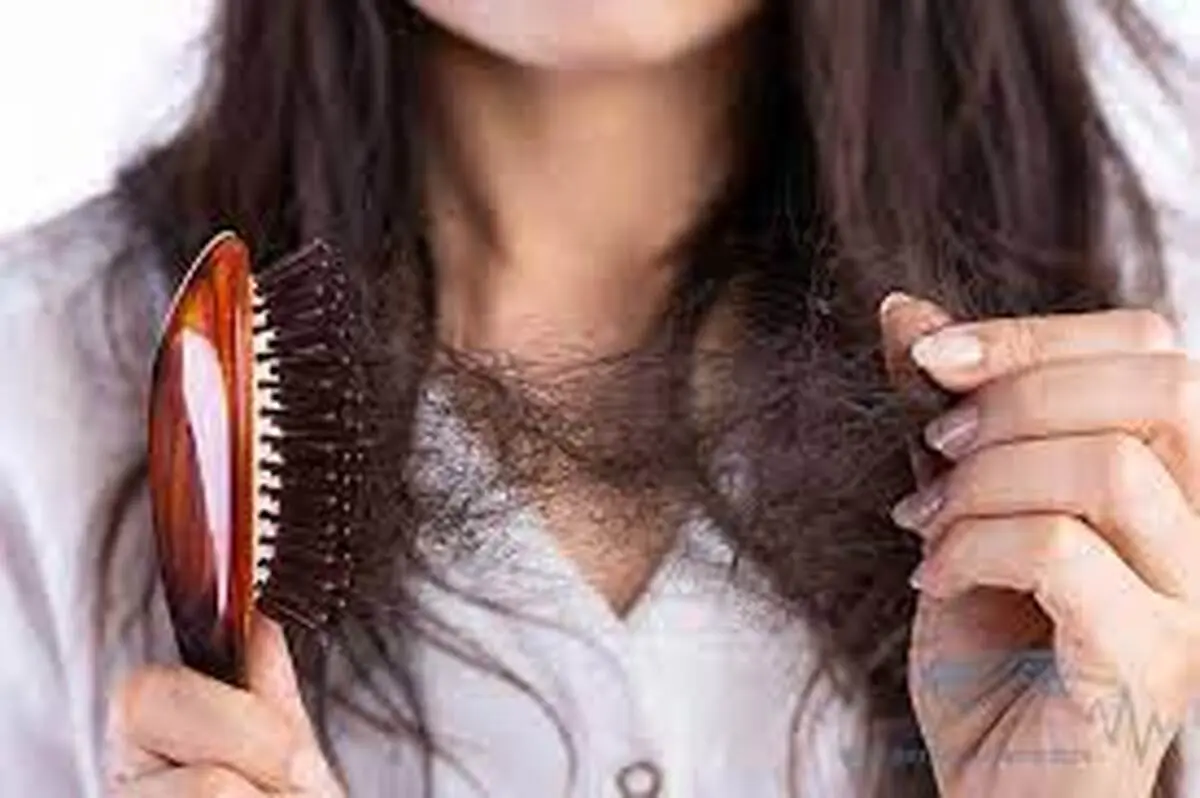 برای جلوگیری از ریزش  مو از خوردن ۵ خوراکی صرف نظر کنید 