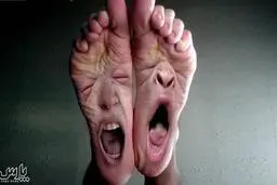 ضعف پا یا بیقراری پا درمان دارد؟ | اگر شما هم به این مشکل مبتلا هستید بخوانید