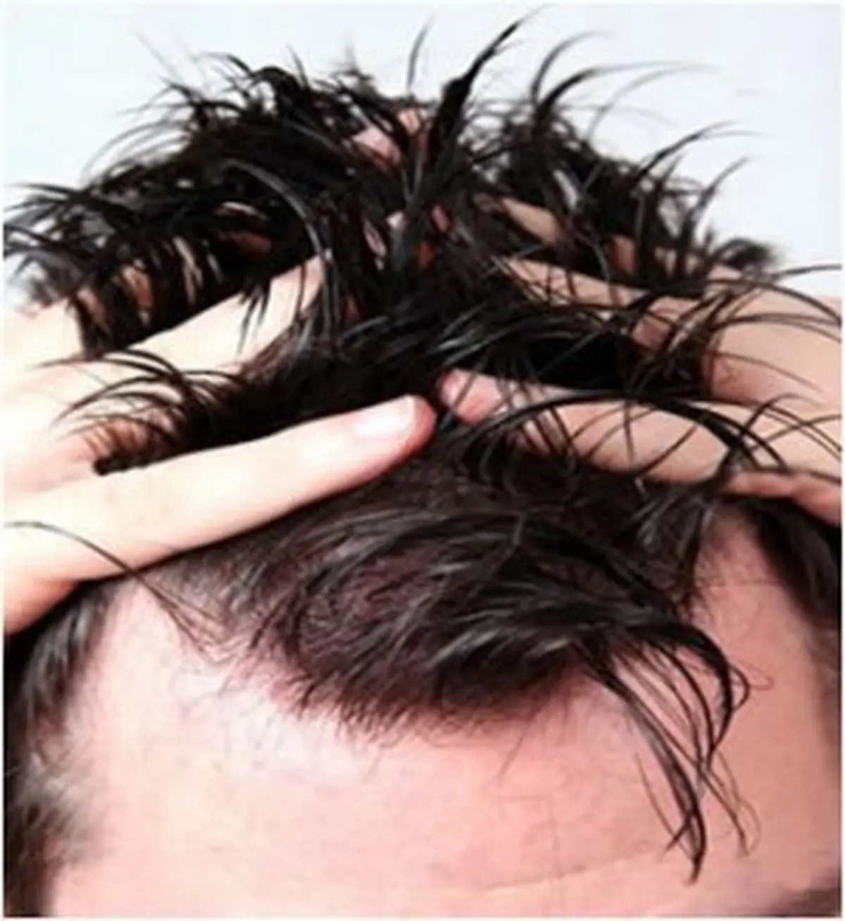 علت و روش درمان های خانگی و طبیعی موهای چرب