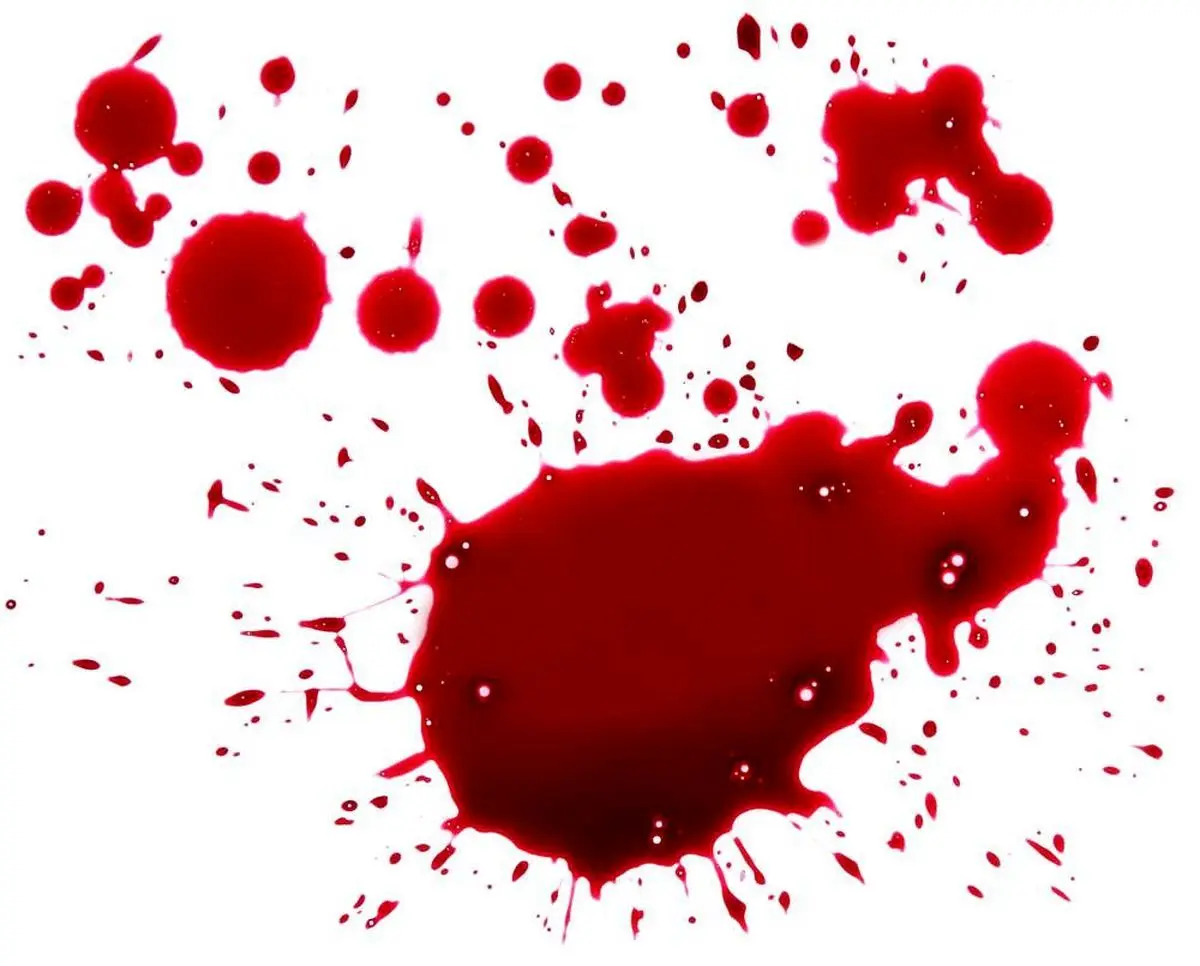 درگیری خونین ۲ پزشک متخصص در نیشابور | پزشک ضارب خودکشی کرد
