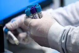 علائم اولیه کرونا براساس جنسیت و گروه سنی را بشناسید